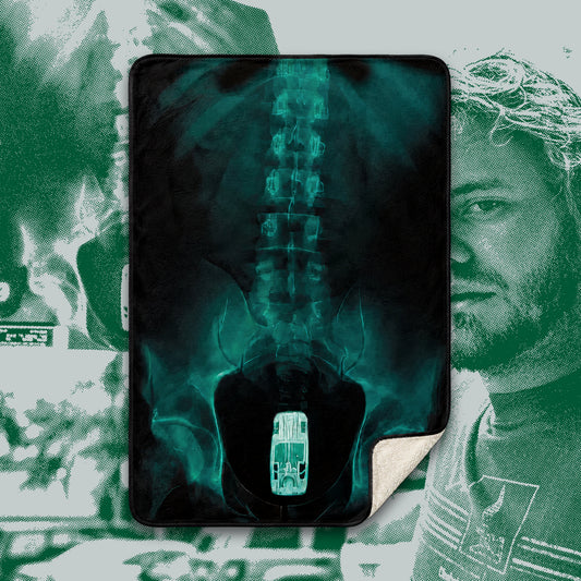 x-ray sherpa fleece throw blanket *pre-order*