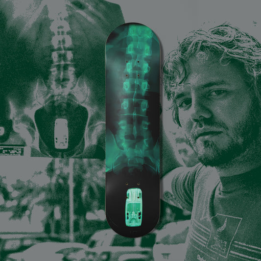 x-ray 8.25" skate deck *pre-order*